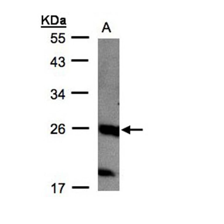 C1orf57 antibody from Signalway Antibody (22295) - Antibodies.com