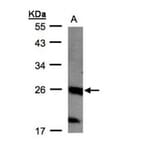 C1orf57 antibody from Signalway Antibody (22295) - Antibodies.com