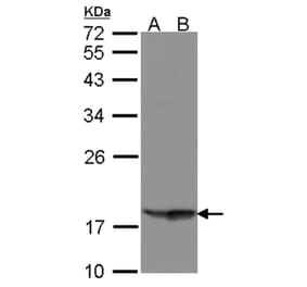 RARRES3 antibody from Signalway Antibody (22308) - Antibodies.com