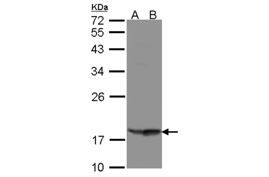 RARRES3 antibody from Signalway Antibody (22308) - Antibodies.com