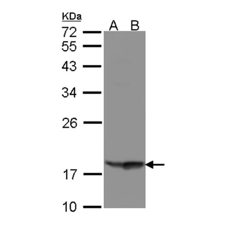 RARRES3 antibody from Signalway Antibody (22308) - Antibodies.com