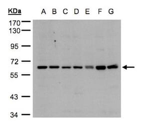 CYP24A1 antibody from Signalway Antibody (22321) - Antibodies.com