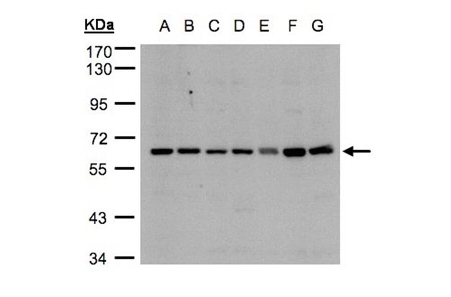 CYP24A1 antibody from Signalway Antibody (22321) - Antibodies.com