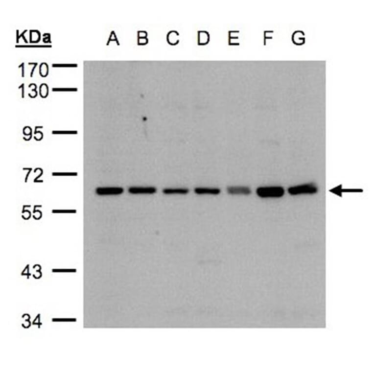 CYP24A1 antibody from Signalway Antibody (22321) - Antibodies.com