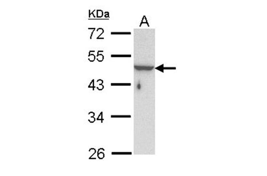 KRTHA3B antibody from Signalway Antibody (22352) - Antibodies.com
