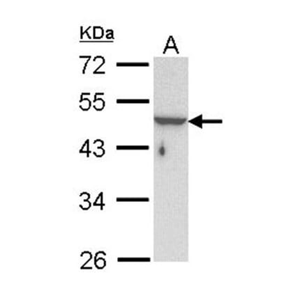 KRTHA3B antibody from Signalway Antibody (22352) - Antibodies.com