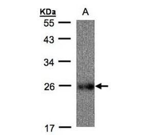 UQCRFS1 antibody from Signalway Antibody (22494) - Antibodies.com