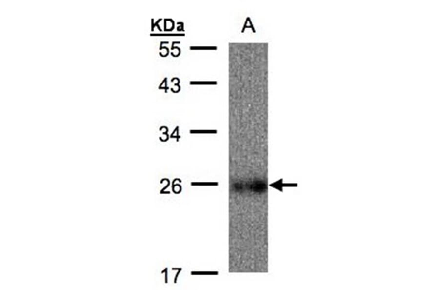 UQCRFS1 antibody from Signalway Antibody (22494) - Antibodies.com