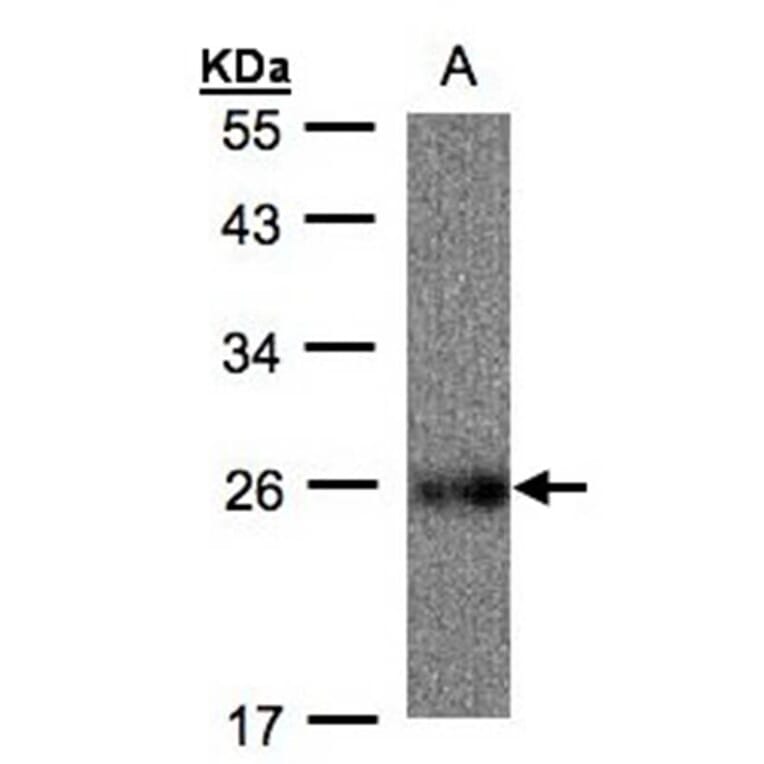 UQCRFS1 antibody from Signalway Antibody (22494) - Antibodies.com
