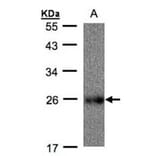 UQCRFS1 antibody from Signalway Antibody (22494) - Antibodies.com