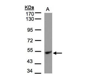 UQCRFS1 antibody from Signalway Antibody (22495) - Antibodies.com