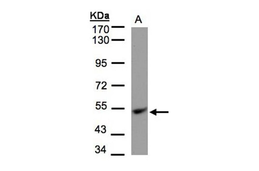 UQCRFS1 antibody from Signalway Antibody (22495) - Antibodies.com