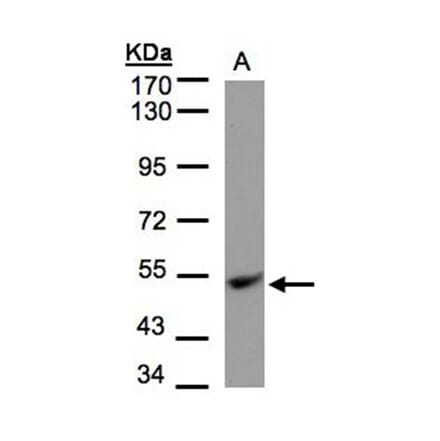 UQCRFS1 antibody from Signalway Antibody (22495) - Antibodies.com