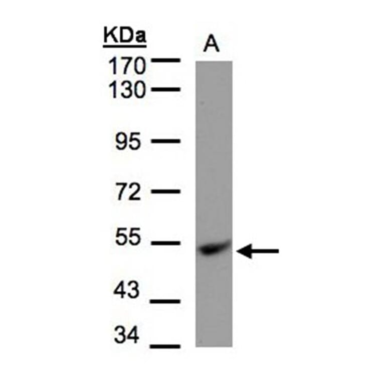 UQCRFS1 antibody from Signalway Antibody (22495) - Antibodies.com