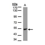 UQCRFS1 antibody from Signalway Antibody (22495) - Antibodies.com