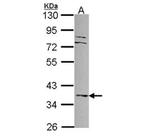 MKP-3 antibody from Signalway Antibody (22692) - Antibodies.com