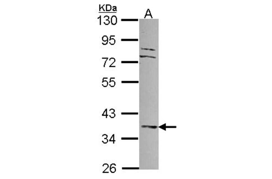 MKP-3 antibody from Signalway Antibody (22692) - Antibodies.com