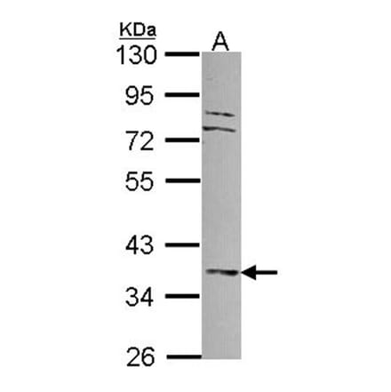MKP-3 antibody from Signalway Antibody (22692) - Antibodies.com
