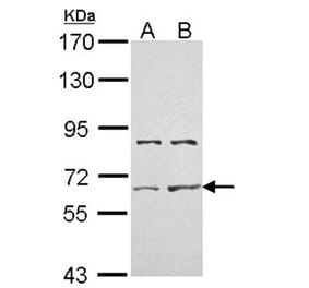 ACTR-II antibody from Signalway Antibody (22695) - Antibodies.com