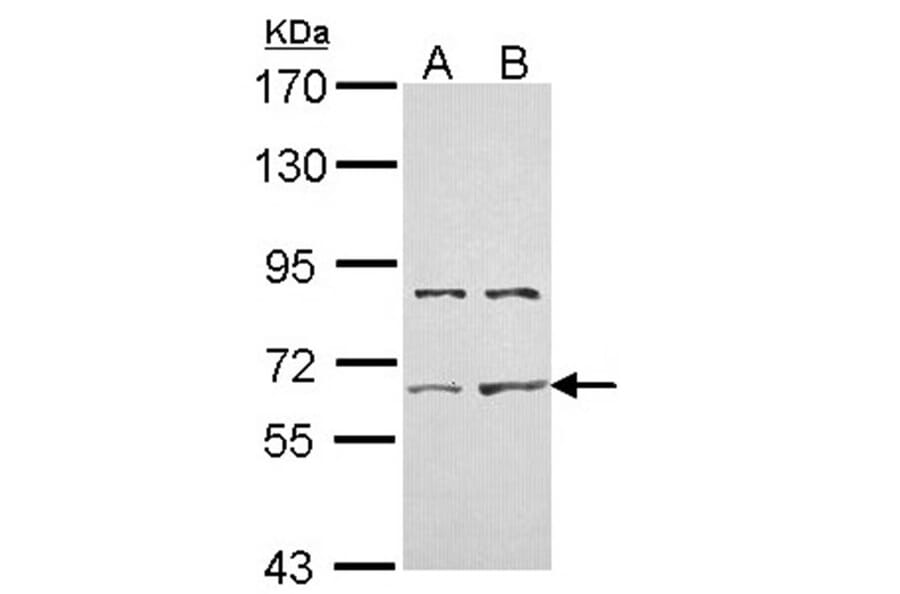ACTR-II antibody from Signalway Antibody (22695) - Antibodies.com