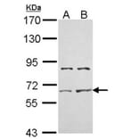 ACTR-II antibody from Signalway Antibody (22695) - Antibodies.com