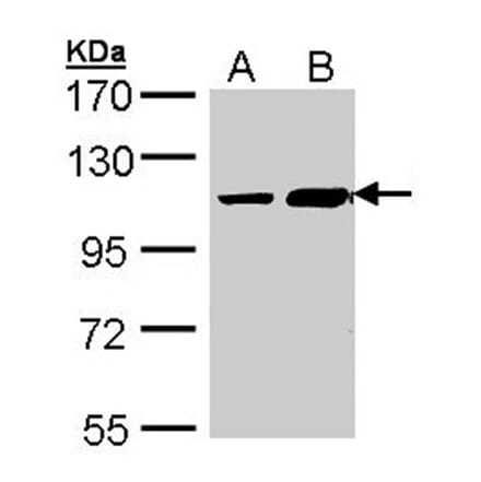 ALS2CR3 antibody from Signalway Antibody (22715) - Antibodies.com