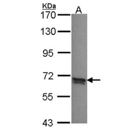 PPP2R5B antibody from Signalway Antibody (22730) - Antibodies.com
