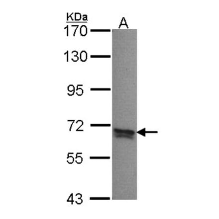 PPP2R5B antibody from Signalway Antibody (22730) - Antibodies.com