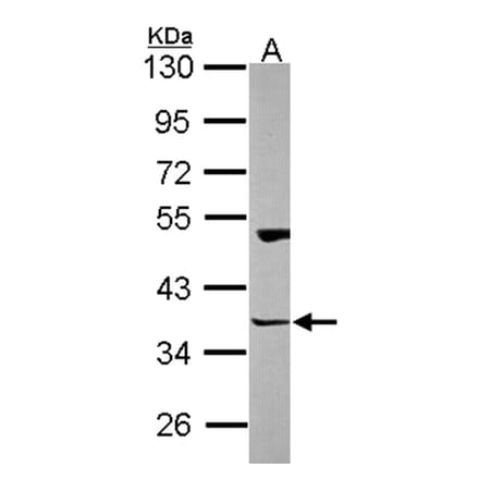 Homer-3 antibody from Signalway Antibody (22744) - Antibodies.com
