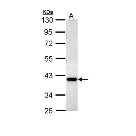 MKP-3 antibody from Signalway Antibody (22773) - Antibodies.com