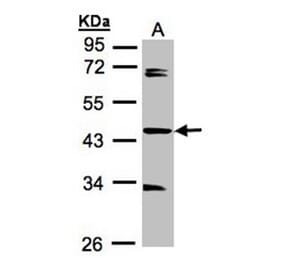 SDCCAG3 antibody from Signalway Antibody (23110) - Antibodies.com