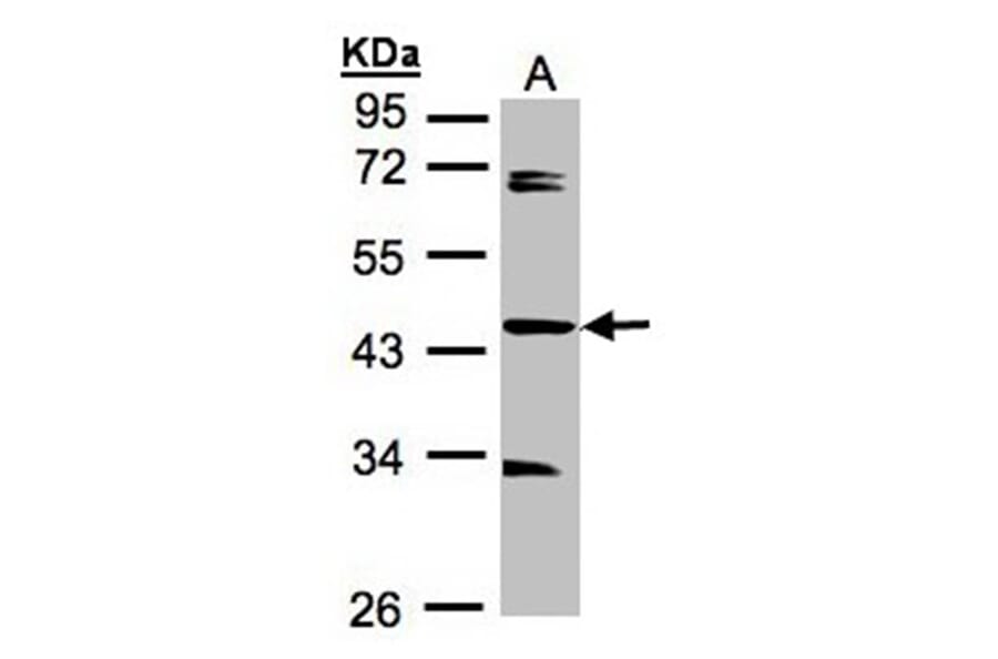 SDCCAG3 antibody from Signalway Antibody (23110) - Antibodies.com