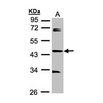 SDCCAG3 antibody from Signalway Antibody (23110) - Antibodies.com