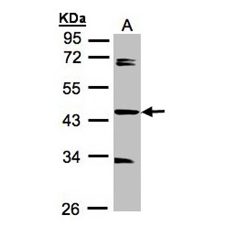 SDCCAG3 antibody from Signalway Antibody (23110) - Antibodies.com