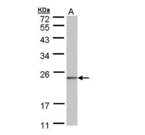 HRPAP20 antibody from Signalway Antibody (23125) - Antibodies.com