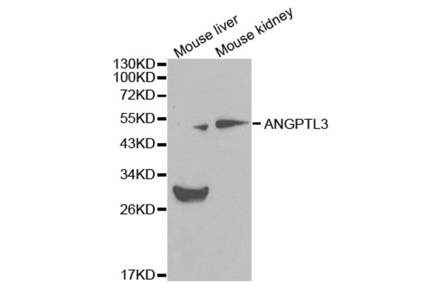 Western blot - ANGPTL3 Antibody from Signalway Antibody (32083) - Antibodies.com