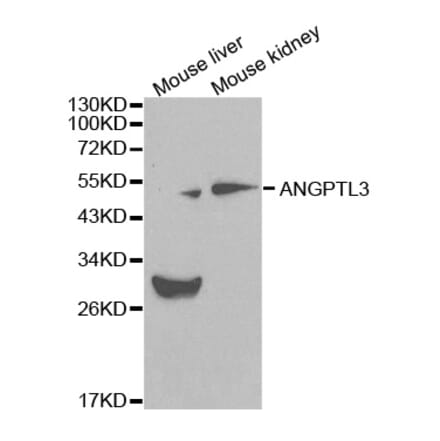 Western blot - ANGPTL3 Antibody from Signalway Antibody (32083) - Antibodies.com