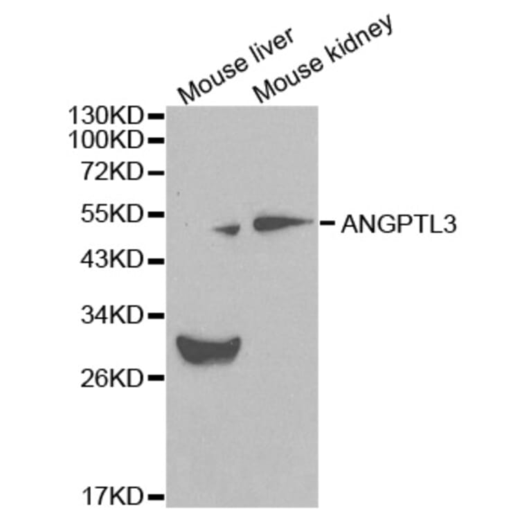 Western blot - ANGPTL3 Antibody from Signalway Antibody (32083) - Antibodies.com