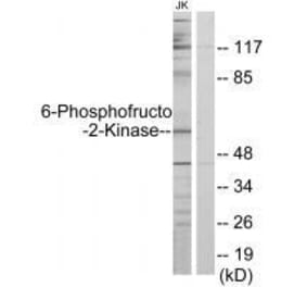 Western blot - PFKFB2 Antibody from Signalway Antibody (33604) - Antibodies.com