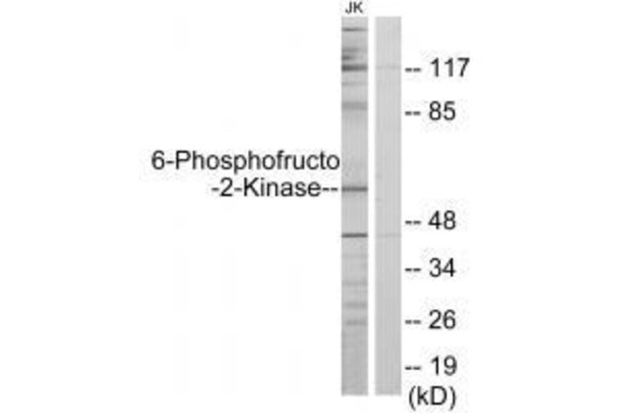 Western blot - PFKFB2 Antibody from Signalway Antibody (33604) - Antibodies.com