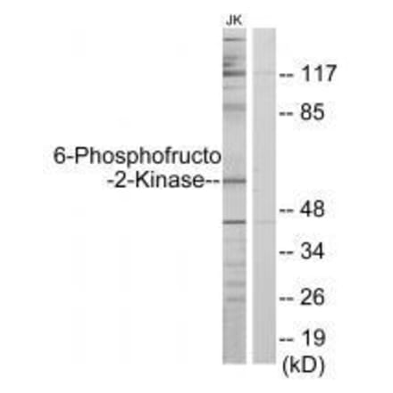 Western blot - PFKFB2 Antibody from Signalway Antibody (33604) - Antibodies.com