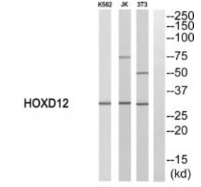 Western blot - HOXD12 Antibody from Signalway Antibody (33758) - Antibodies.com