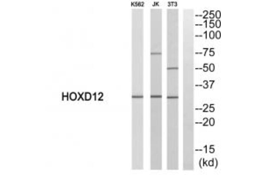 Western blot - HOXD12 Antibody from Signalway Antibody (33758) - Antibodies.com