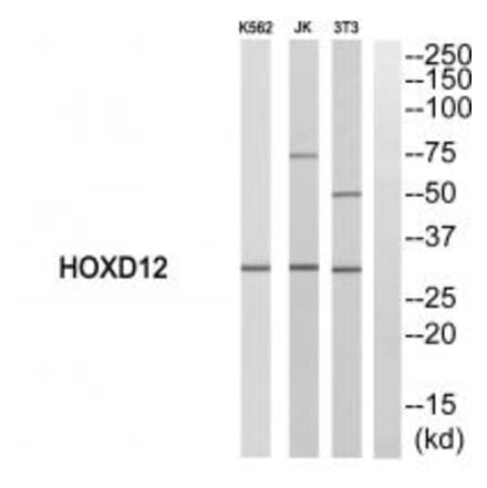 Western blot - HOXD12 Antibody from Signalway Antibody (33758) - Antibodies.com