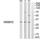 Western blot - HOXD12 Antibody from Signalway Antibody (33758) - Antibodies.com