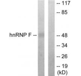 Western blot - hnRNP F Antibody from Signalway Antibody (33806) - Antibodies.com
