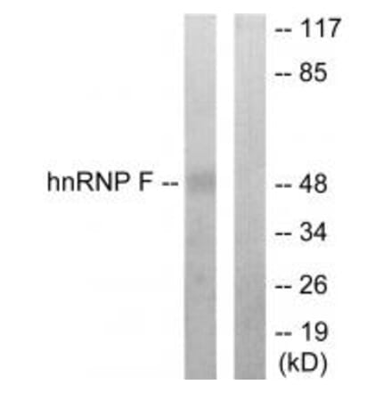 Western blot - hnRNP F Antibody from Signalway Antibody (33806) - Antibodies.com