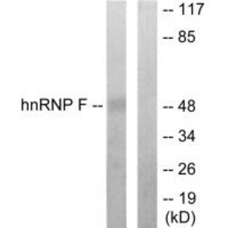 Western blot - hnRNP F Antibody from Signalway Antibody (33806) - Antibodies.com