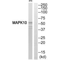 Western blot analysis of extracts from HeLa cells, 293 cells and Jurkat cells, using MAPK10 antibody #33816.