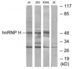 Western blot - hnRNP H Antibody from Signalway Antibody (33824) - Antibodies.com